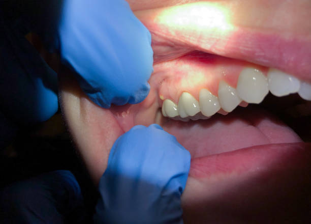 Best Emergency Orthodontic Repairs in New Berlinville, PA